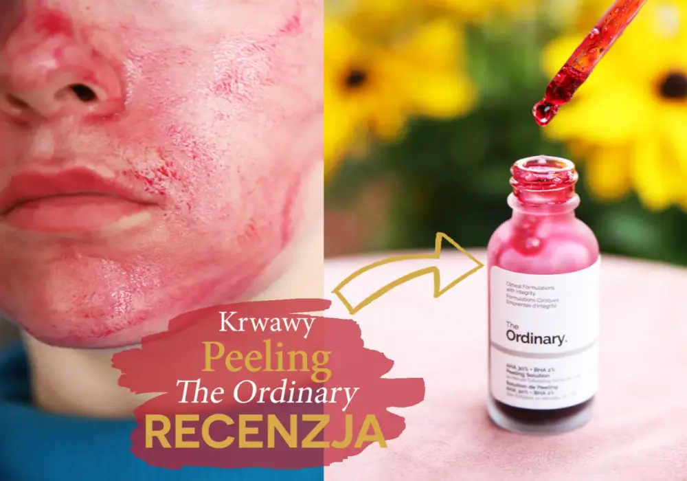 Jak bezpiecznie używać The Ordinary Krwawe Peeling? Instrukcja krok po kroku i ważne wskazówki