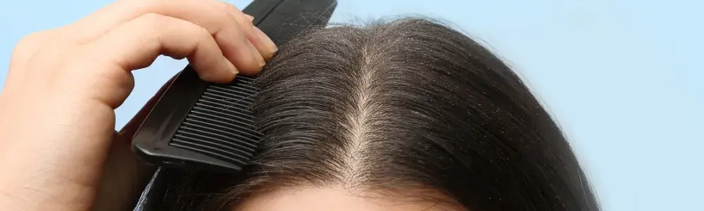 Jak nakładać peeling na skórę głowy, by uniknąć podrażnień i zyskać zdrowe włosy