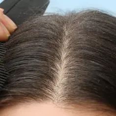 Jak nakładać peeling na skórę głowy, by uniknąć podrażnień i zyskać zdrowe włosy